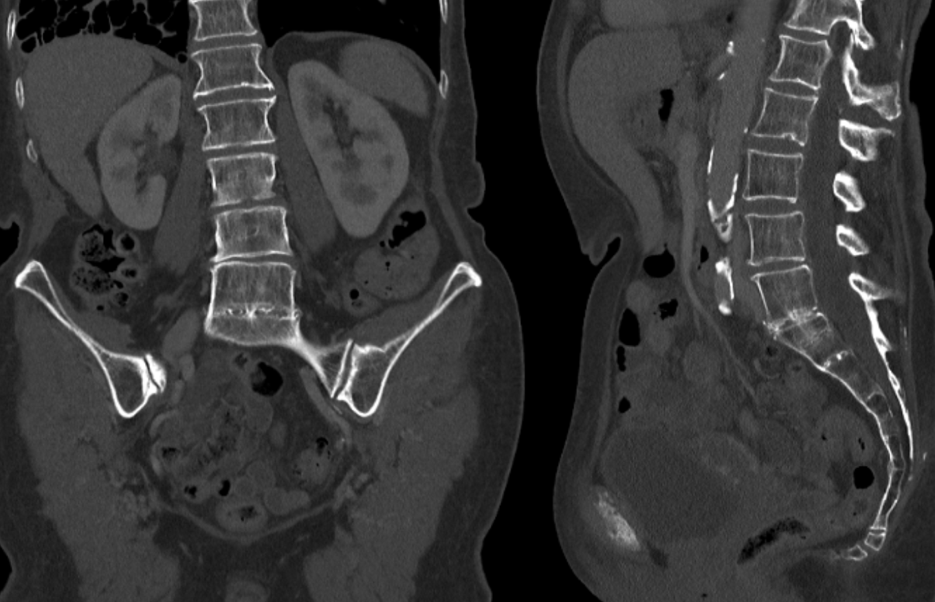 Computertomografie CT Radiologie Filstal Computertomografie CT Radiologie Filstal